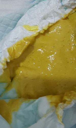 Hello po. Ask lang po ako kung nagtatae po ba ito??