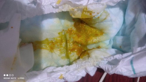 Poop ni baby normal ba?