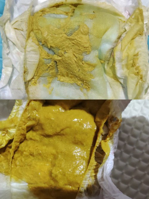 Help me mga momshy 🥺🙏