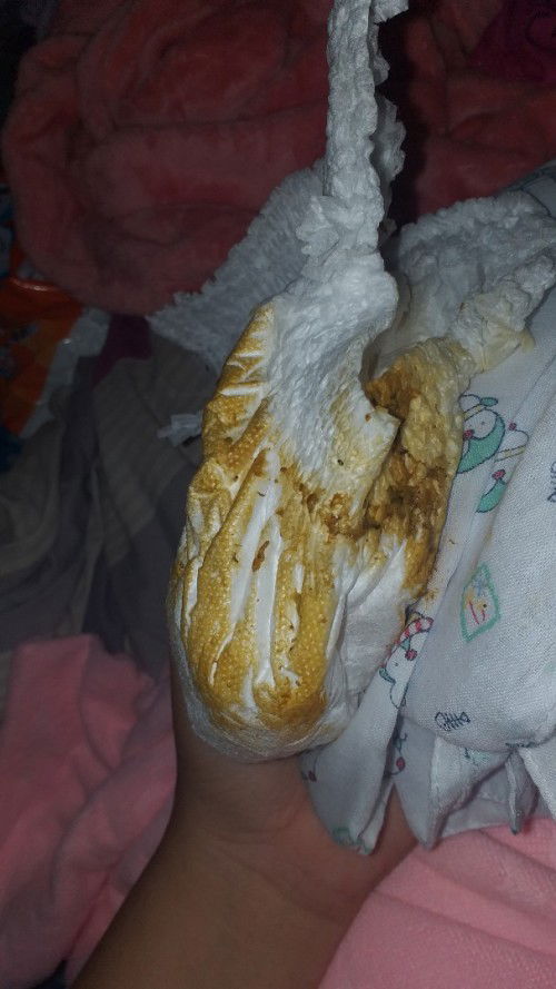 เเบบนี้ใช่น้องทองเสียไหมคะ