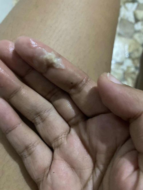 มีมูกตอนท้อง3สัปดาห์