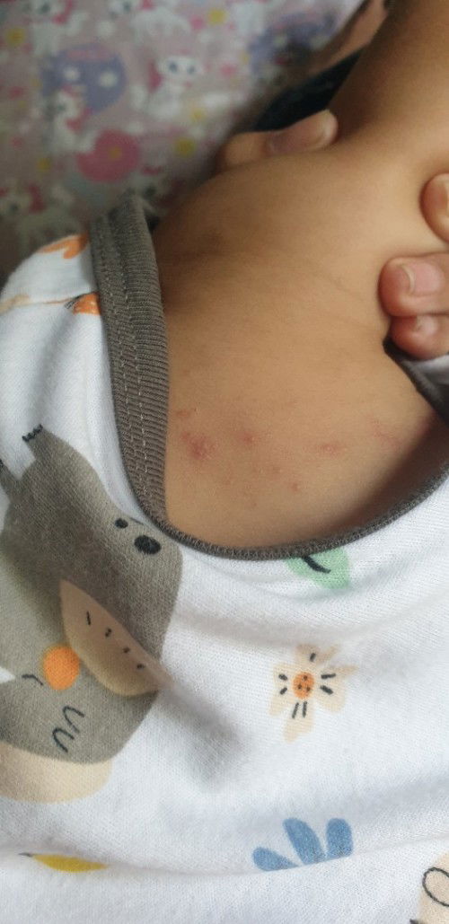 Bayo 6 bulan bentol merah seperti ada nanahnya.