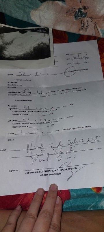 First time po!ask lang po kung ano sa tingen niyo po?