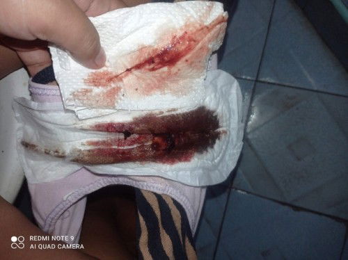 Mucus plug na kaya ito mga mommies?