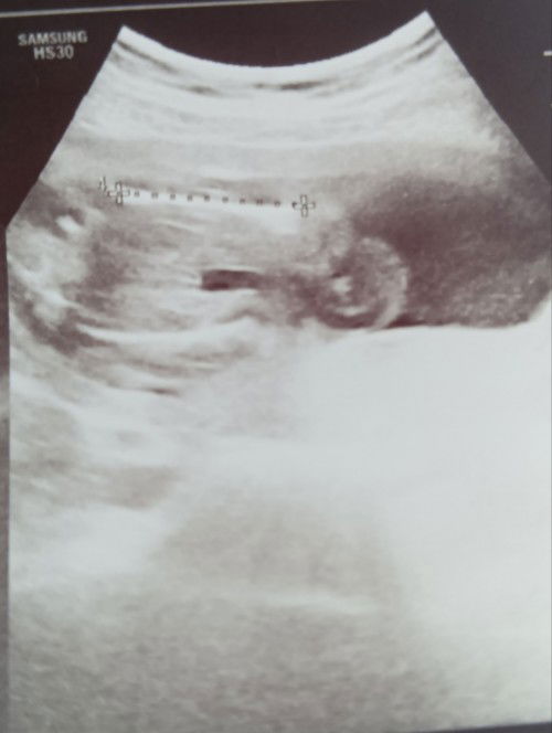 I can't stop smiling, I am having a boy 😊