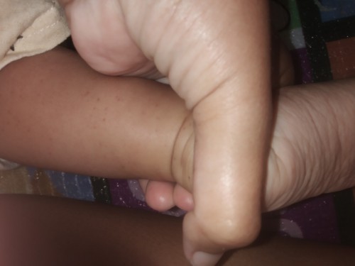 เกล็ดเลือดต่ำ