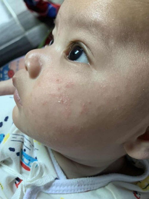 เกิดจากอะไรคะ?