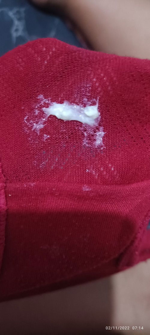 Mucus plug na po ba ito?