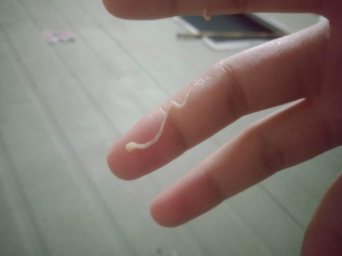 ตอนนี้ท้องได้37w5dมีเเบบนี้ไหลออกมาเเต่ไม่เยอะเป็นอะไรไหมคาะต้องรีบไปหาหมอไหมใครรู้บอกหน่อยนะท้องเเร