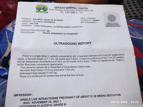 Ultrasound for 36weeks..