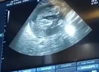 2x hasil USG jk janin berbeda .. para bunda ada yg ngerti gk sama hasil ini yg