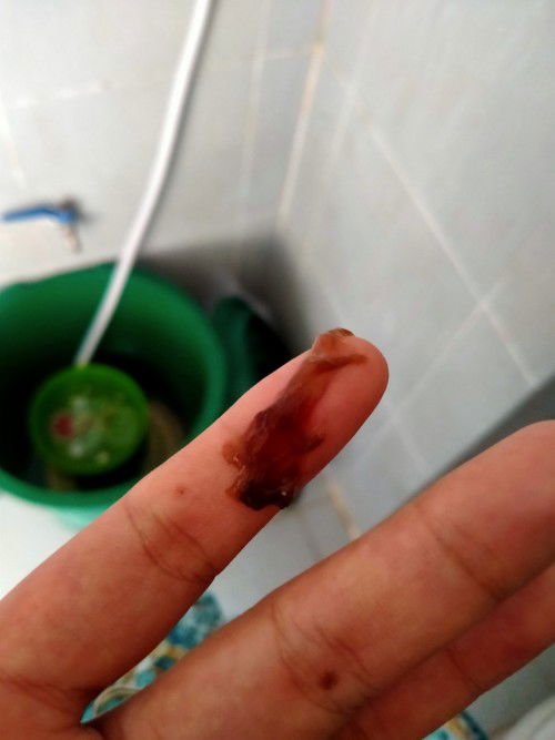 สอบถามแม่ๆหน่อยค่ะ แบบนี้คือต้องไปหาหมอไหมค่ะ