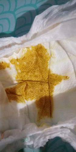 Breastfed Poop