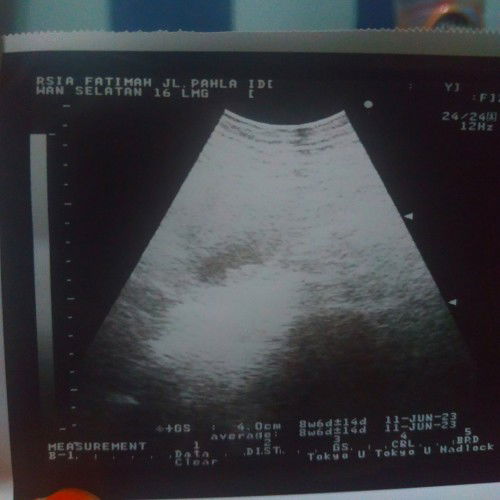 Hasil USG Dokter