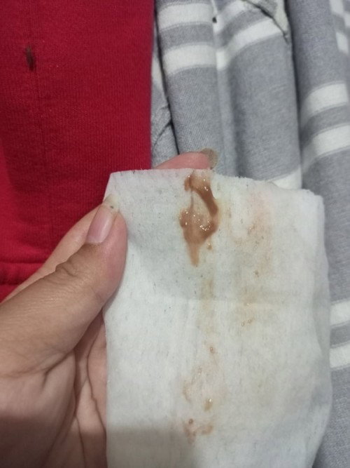 Mucus Plug