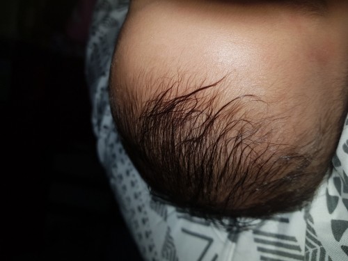 Mau tanya, wajar gak sih usia 5bulan selalu keringetan kalo lg nenenin ? Takutnya dehidrasi bun :(