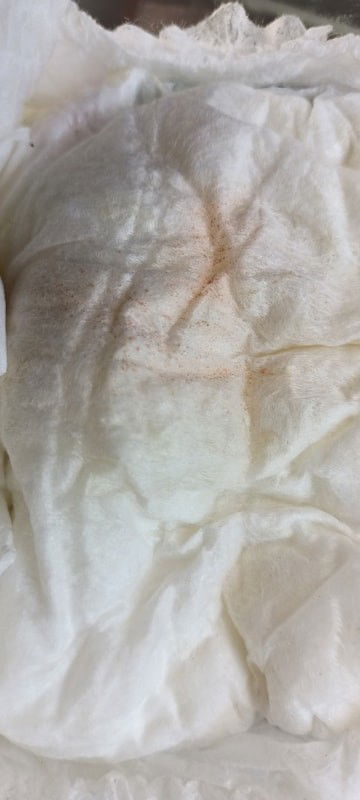 Urine keluar noda merah tapi bukan darah