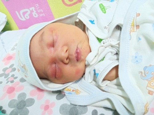 สอบถามคุณลูกบ้านไหนเคยขึ้นแบบนี้ไหมคะ อยากรุ้ว่าลุกเป็นอะไรทำยังไงจะหาย