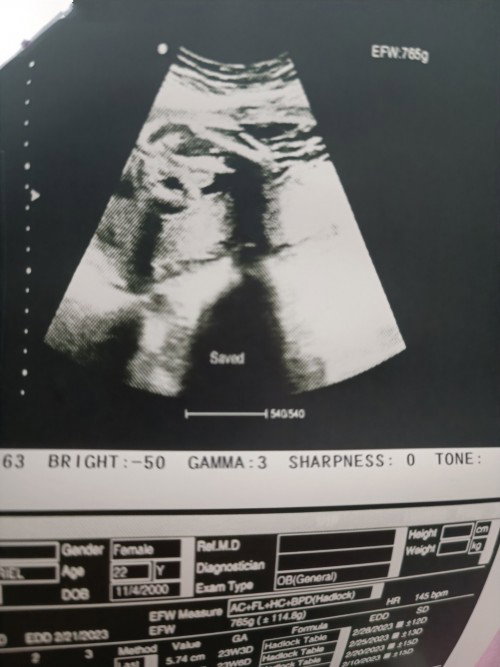 Baby girl or baby boy? Thanks po sa sasagot. Hehe