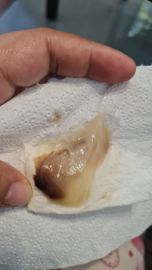 Mucus plug po ba ito? I'm on 37weeks 3 days