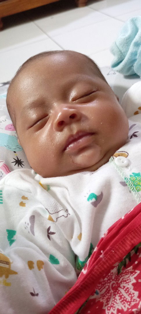 Timbul putih di dagu bayi