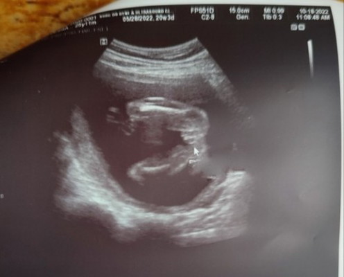 Gender ni baby