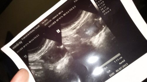 Karena lupa trakhir haid soalnya bekas kb jd haid ga nentu...