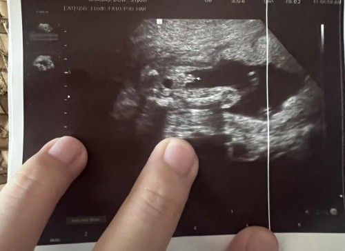 gender ftm 5 mos