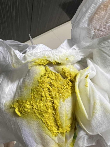 baby poop formula feed