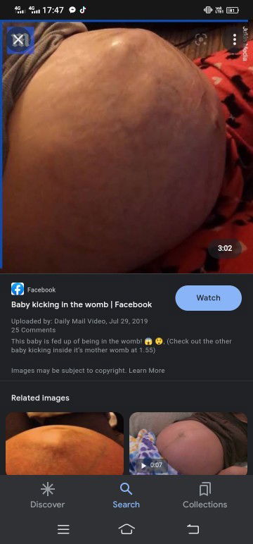 Gerakan janin yang menonjol