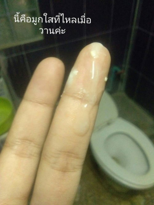 ท้องได้37วีค4วัน