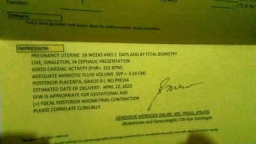 natural lang ba nakadapa si baby sa tummy ni mommy?