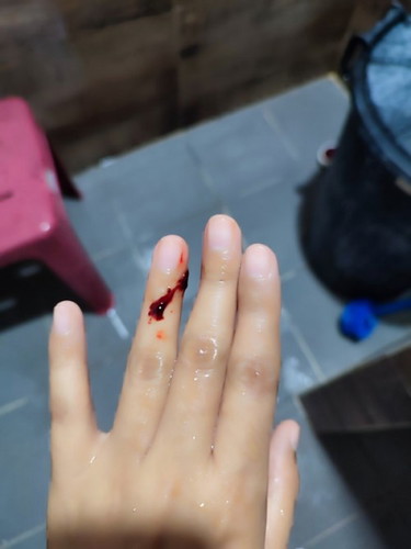 แท้งคุกคาม 6 w ขอคำปรึกษาหน่อยค่ะ