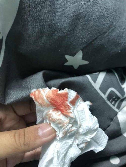 มีเลือดปนน้ำคาวปลา