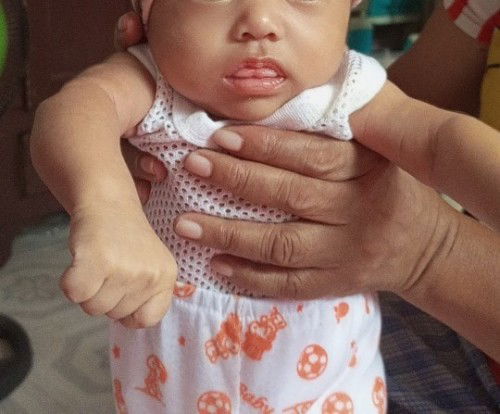 Mga momies normal lang ba to sa baby na parati nakalabas Ang dila Minsan kahit tulog Siya?