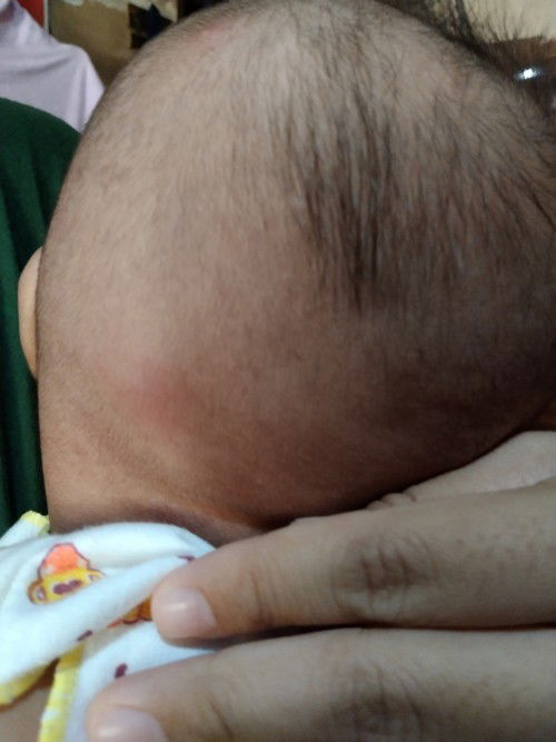 Bun ini apa ya,
mohon infonya yg tau