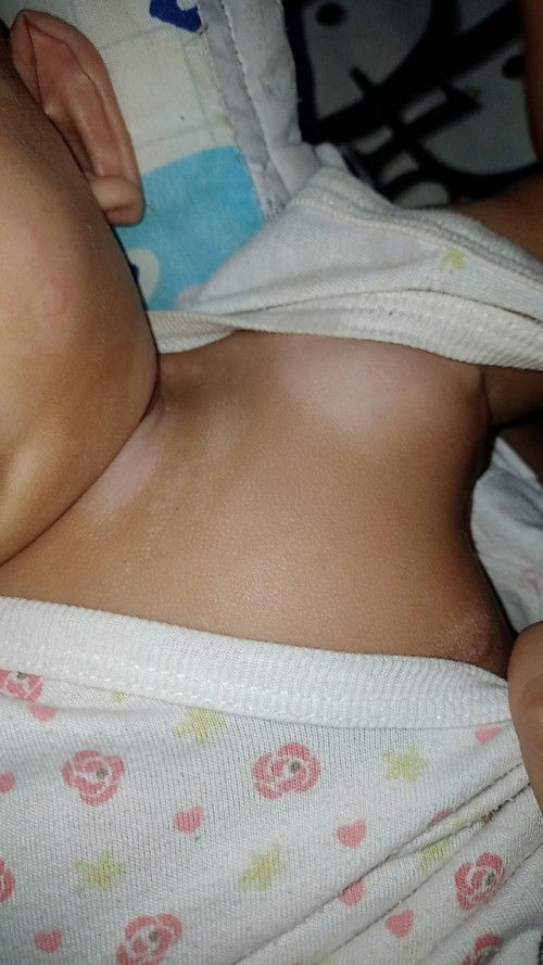 sino Po same Ng situation Ng baby na ganto? parang an an Po kumakalt sa katawan niya  ano ponh ginwa