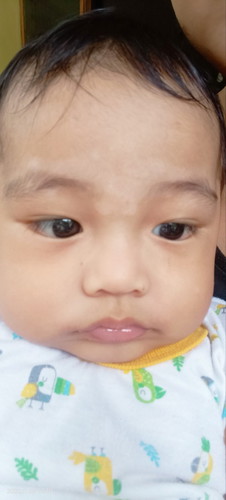 momsh ano Po kaya yang puti na yan sa muka Ng baby ko..any advice Po???