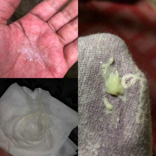 pasintabi po ano po itong lumalabas sa akin, di naman humihilab tyan ko pero sobrang sakit ng