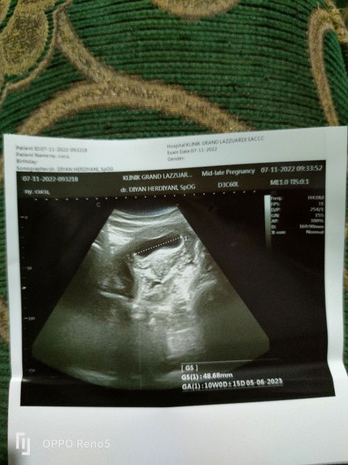 12 week tapi janin belum terlihat