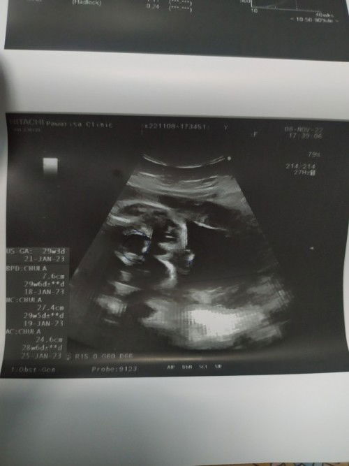 รบกวนช่วยดูหน่อยค่ะว่าน้องเป็นผู้หญิงหรือผู้ชาย