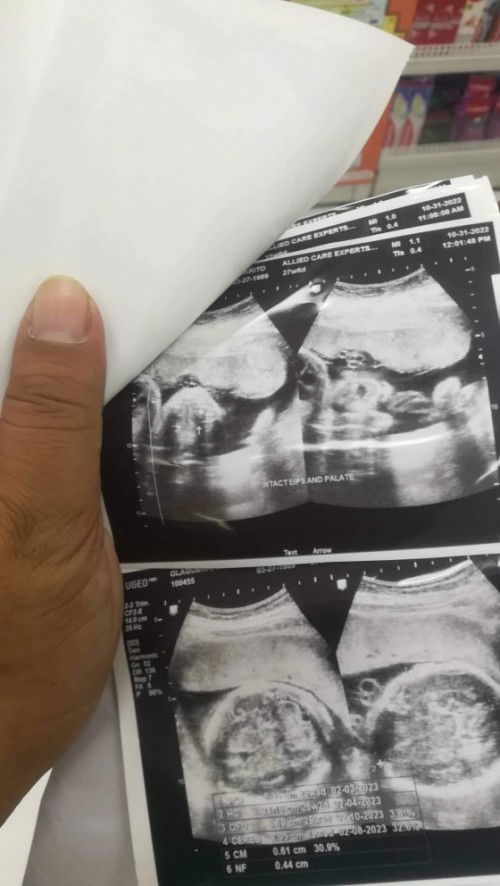 Help nmn p anu p b kailngn kainin ng buntis para po madagdagan po ng timbang 1.1pounds lng po baby k