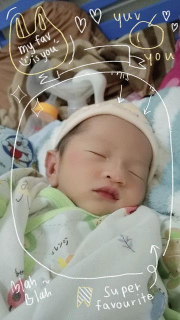 สวัสดีครับผมเด็กชายพชรพล 36+4 คลอดวันที่31/10/65 วันนัดคลอดวันที่24/11/65 ผมรอไม่ไหวเลยแอบแตกก่อนคับ