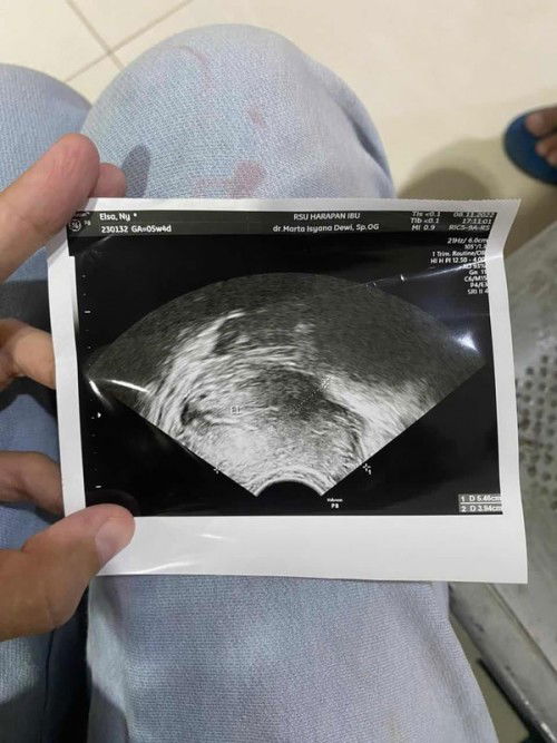 testpack positif tapi pco