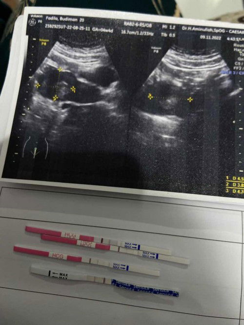 Apakah bunda bunda smaa 4 minggu ushgbelum keliatan?