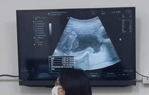 ตื่นเต้น ท้องแรก