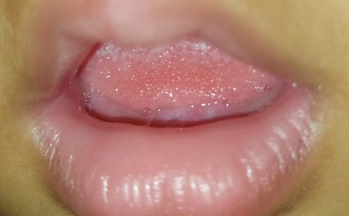 Tipstumgi biar ngga rewel dong bun