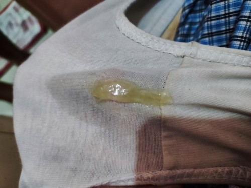Mucus plug?