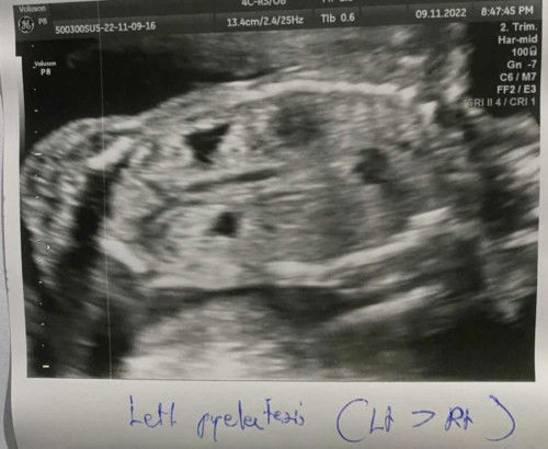 สอบถามแม่ๆที่มีประสบการณ์