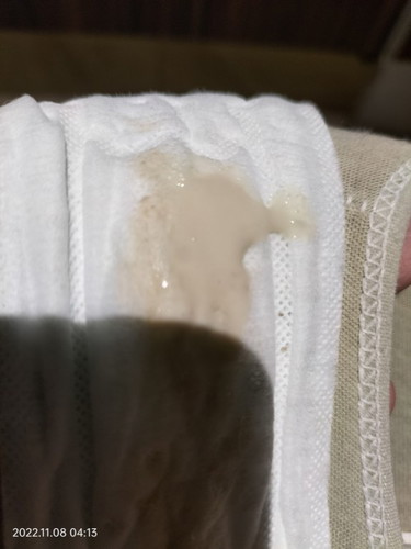 ตกขาวแบบนี้ผิดปกติมั้ย